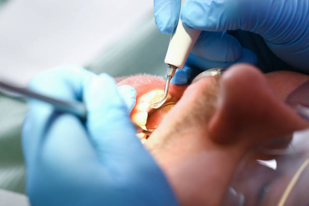 Best Emergency Dentist for Knocked-Out Tooth in Oreland, PA