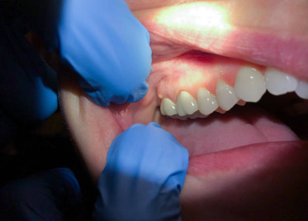 Best Urgent Dental Care for Toothache in Oreland, PA