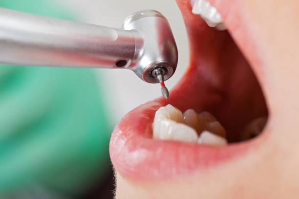 Best Broken or Cracked Tooth Emergency Dentist in Oreland, PA